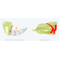 Myobrace dentition permanente classe III étape 2 - P-3