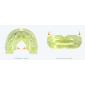 Myobrace dentition permanente classe III étape 2 - P-3