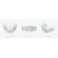 Myobrace Adult Aligner étape1 – AA1