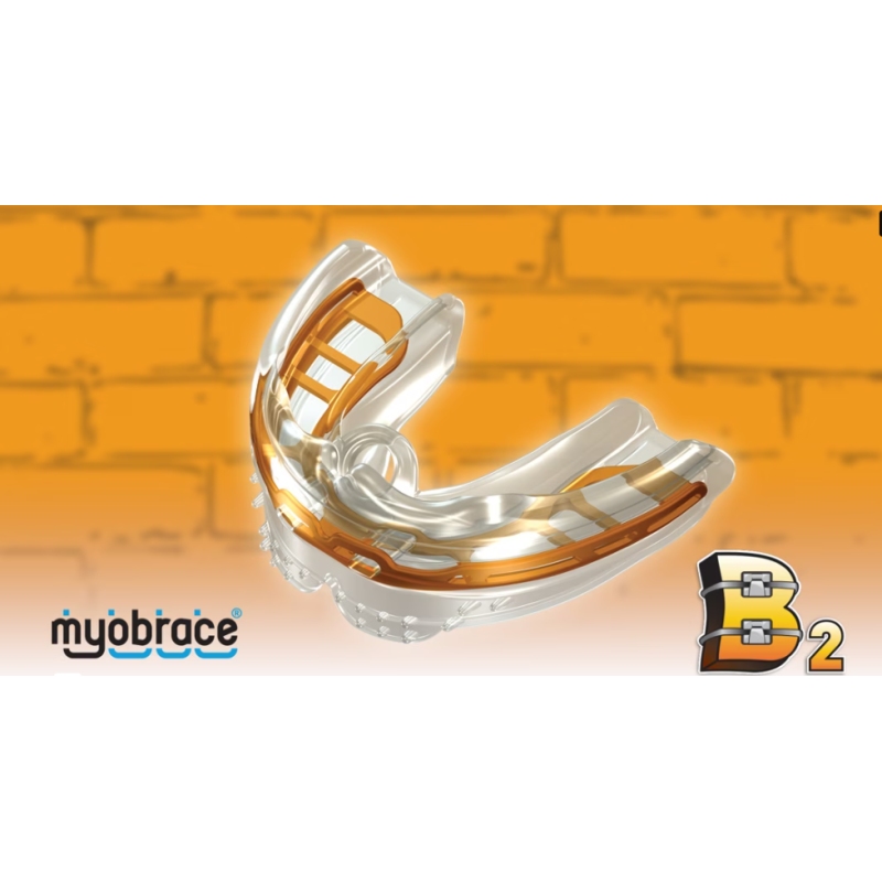 Myobrace for Braces B2